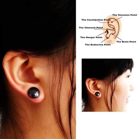 , Exposure to radiation: a. . Where to place magnetic earrings for weight loss